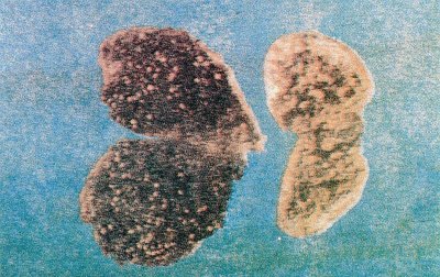 Ekşilik böceği zararı görmüş kuru incir meyveleri